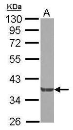 NCK2 Polyclonal Antibody