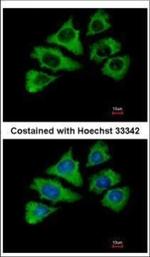 HSP701L Antibody in Immunocytochemistry (ICC/IF)