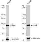 RSK2 Polyclonal Antibody