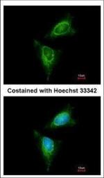 RSK1 Antibody in Immunocytochemistry (ICC/IF)