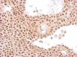 Cdc23 Antibody in Immunohistochemistry (Paraffin) (IHC (P))