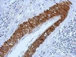 ACVR1B Antibody in Immunohistochemistry (Paraffin) (IHC (P))