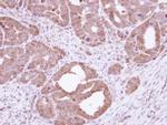 HSC70 Antibody in Immunohistochemistry (Paraffin) (IHC (P))