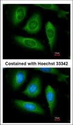 RIP1 Polyclonal Antibody