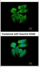PAK1 Polyclonal Antibody