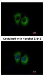 TID1 Polyclonal Antibody