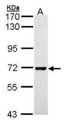 PPIL2 Isoform B Polyclonal Antibody