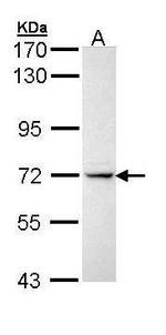 IL1R1 Polyclonal Antibody