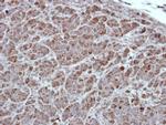 PKC alpha Polyclonal Antibody