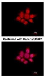 NCK1 Polyclonal Antibody