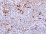 HIPPI Polyclonal Antibody