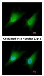 SMAD2 Antibody in Immunocytochemistry (ICC/IF)