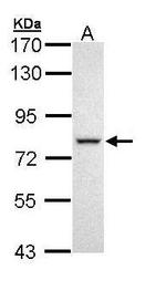 DDX41 Polyclonal Antibody