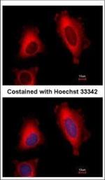 EEF1D Polyclonal Antibody
