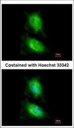 JIP2 Polyclonal Antibody