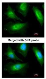 alpha Actinin 2 Polyclonal Antibody