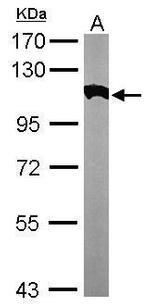 alpha Actinin 2 Antibody in Western Blot (WB)