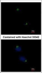 alpha Catenin Polyclonal Antibody