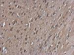 GSK3B Antibody in Immunohistochemistry (Paraffin) (IHC (P))