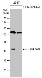 GSK3B Antibody in Western Blot (WB)