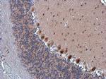 E-cadherin Antibody in Immunohistochemistry (Paraffin) (IHC (P))