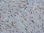 E-cadherin Antibody in Immunohistochemistry (Paraffin) (IHC (P))