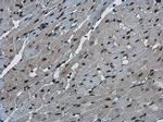 E-cadherin Antibody in Immunohistochemistry (Paraffin) (IHC (P))