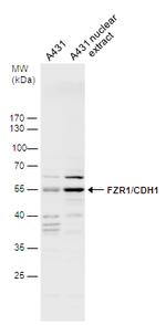 E-cadherin Antibody in Western Blot (WB)