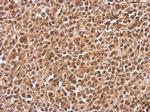 E-cadherin Antibody in Immunohistochemistry (Paraffin) (IHC (P))