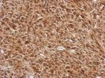 E-cadherin Antibody in Immunohistochemistry (Paraffin) (IHC (P))