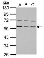 E-cadherin Antibody in Western Blot (WB)