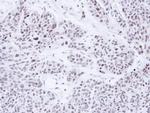 PRP19 Antibody in Immunohistochemistry (Paraffin) (IHC (P))