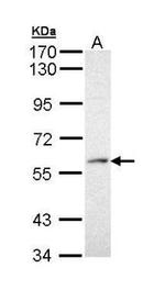 PRP19 Antibody in Western Blot (WB)