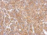 PAK1 Polyclonal Antibody