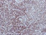 STEP Polyclonal Antibody