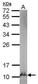 NDUFB3 Polyclonal Antibody