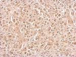 CIAPIN1 Antibody in Immunohistochemistry (Paraffin) (IHC (P))