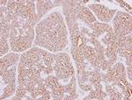 CARD10 Polyclonal Antibody