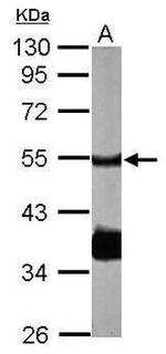 PPP2R2B Antibody in Western Blot (WB)
