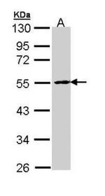 PPP2R2B Antibody in Western Blot (WB)