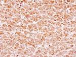 PPM1B Antibody in Immunohistochemistry (Paraffin) (IHC (P))