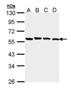 PPM1B Antibody in Western Blot (WB)