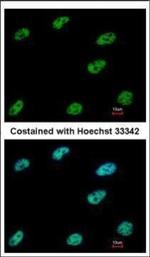 CtBP1 Polyclonal Antibody
