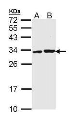 APIP Antibody in Western Blot (WB)
