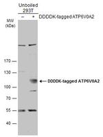 ATP6V0A2 Polyclonal Antibody