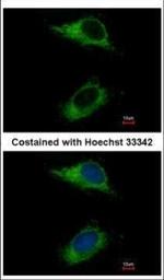 CARD6 Antibody in Immunocytochemistry (ICC/IF)