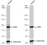 RSK2 Antibody in Western Blot (WB)