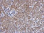 TIMP1 Antibody in Immunohistochemistry (Paraffin) (IHC (P))