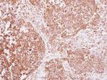 INSR Polyclonal Antibody