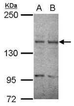 RET Polyclonal Antibody
